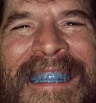 blueteeth6.jpg