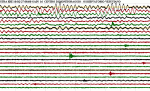 STRAEHE2.gif